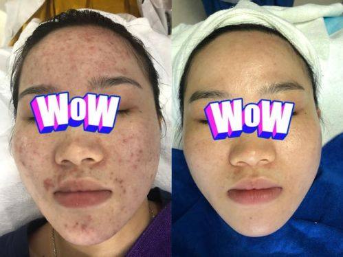 清远天美整形医院口碑评价: