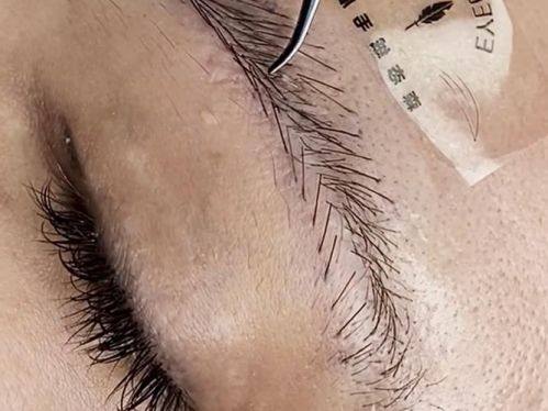 福州百纭凯曼整形美容门诊部怎么样？