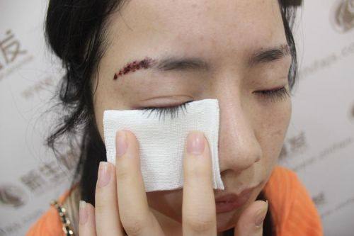 福州百纭凯曼整形美容门诊部预约挂号方式：