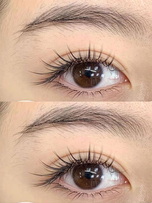 锦州福际植发擅长项目: