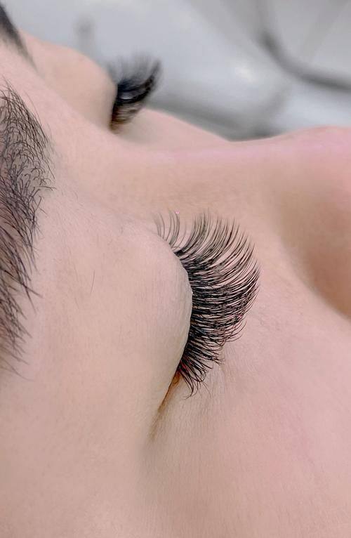 锦州福际植发价格表: