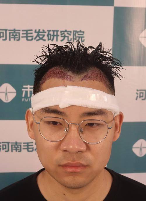 美雅特整形美容中 心预约挂号方式