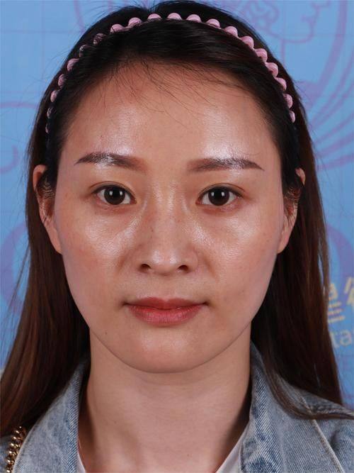 舟山市普陀妃斯整形医疗美容门诊部价格表: