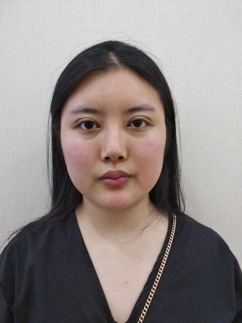 清远天美整形医院价格表: