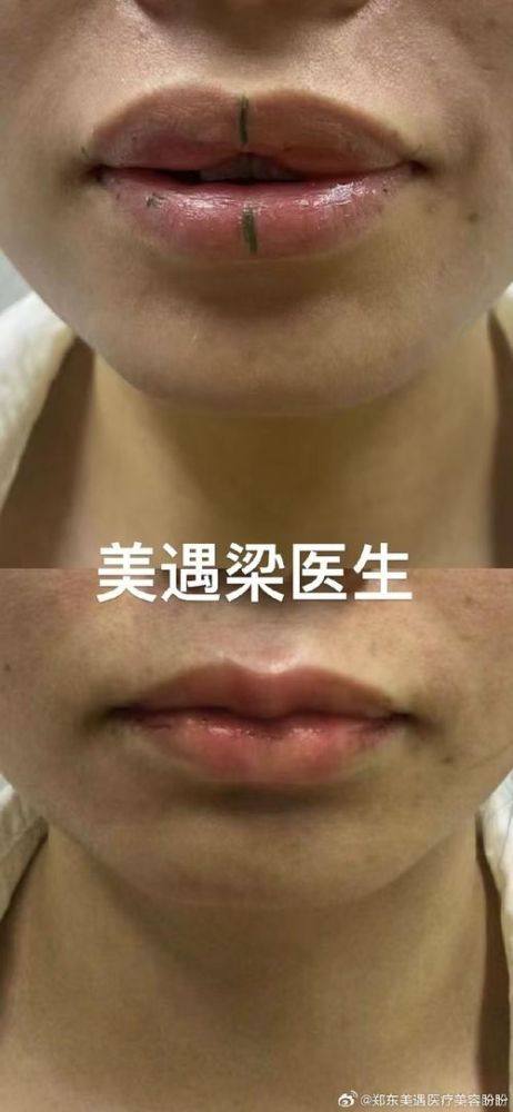 台湾全美整形診所预约挂号方式