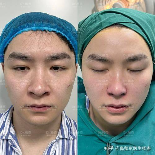 三亚悦已婕熹卡医疗美容外科门诊部擅长项目: