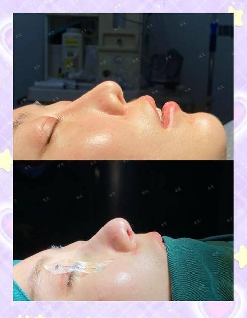 福州百纭凯曼整形美容门诊部口碑评价：