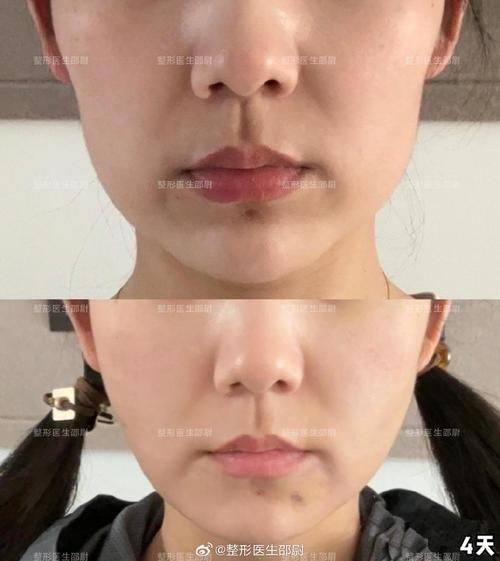 杭州加颜医疗美容怎么样？