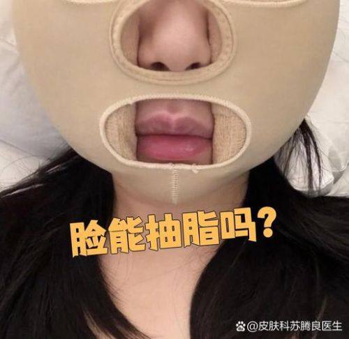 美雅特整形美容中 心擅长项目