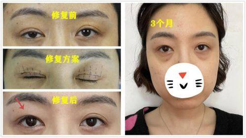 台湾全美整形診所地址电话及营业时间