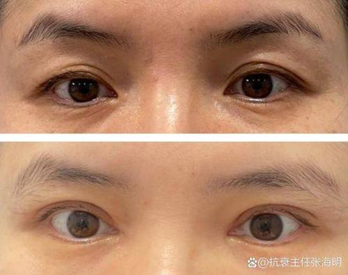 台湾全美整形診所怎么样