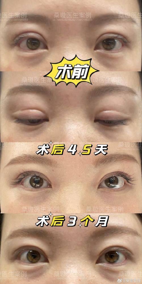 清远天美整形医院预约挂号方式: