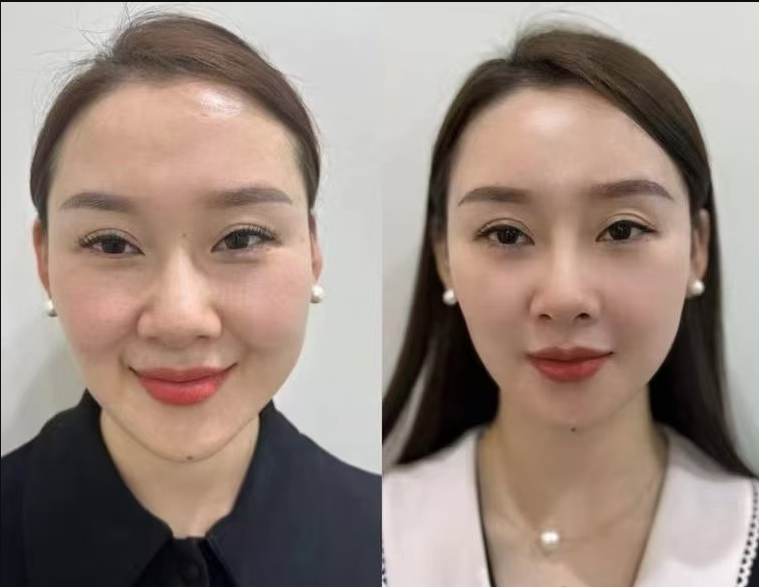 上海百禾国内外整形医疗美容诊所怎么样?