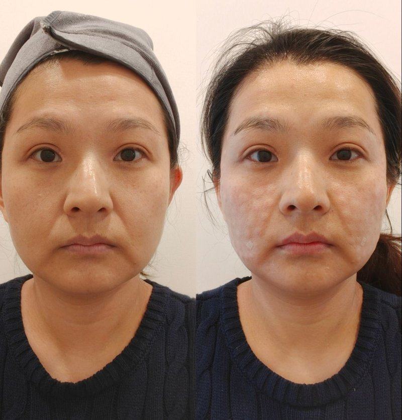 成都微微聚美整形美容门诊部怎么样?