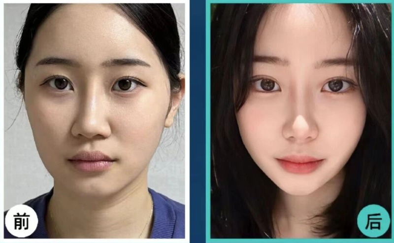 上海百禾国内外整形医疗美容诊所口碑评价