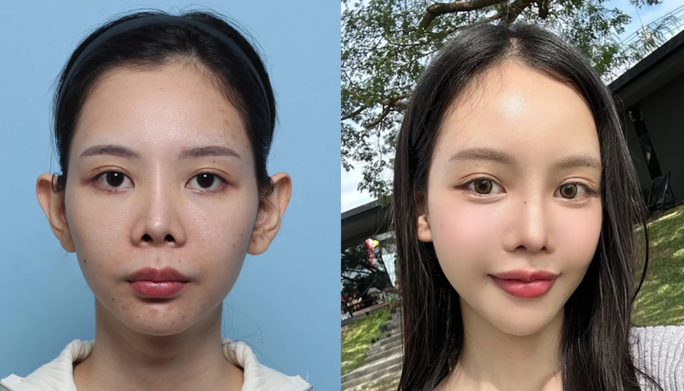 成都微微聚美整形美容门诊部医生名单及擅长领域: