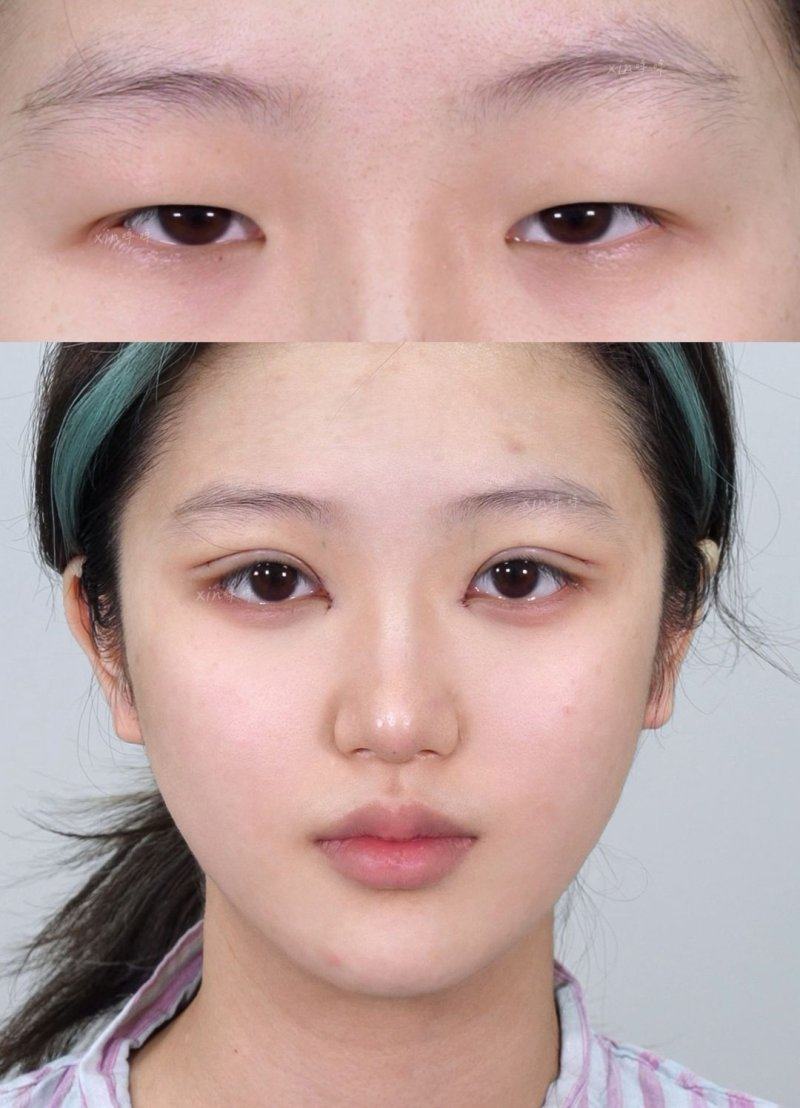 舟山市普陀妃斯整形医疗美容门诊部擅长项目: