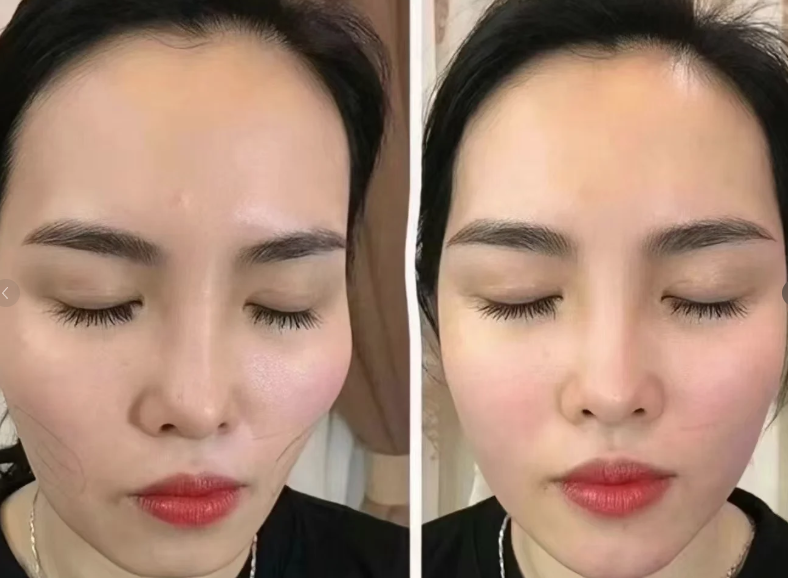 海州区巨龙社区华美整形医疗美容门诊部口碑评价：