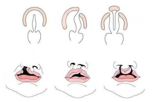 五、若怀疑操作不当导致眼袋,如何维护自身权益