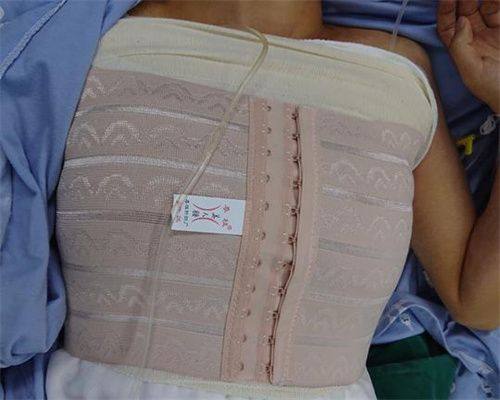 三、不同诱因下的修复与护理方案全梳理