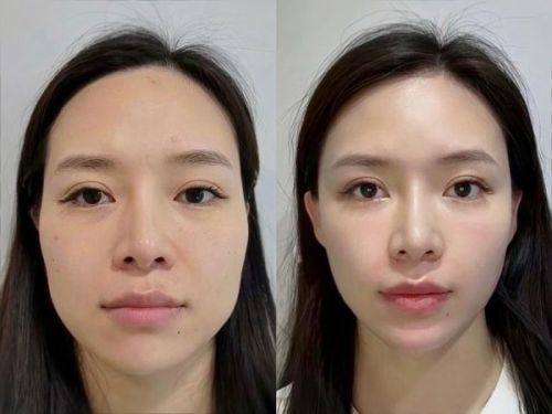 金容燮医生怎么预约