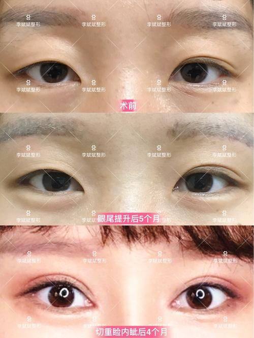 长春阳光女子医院预约挂号方式