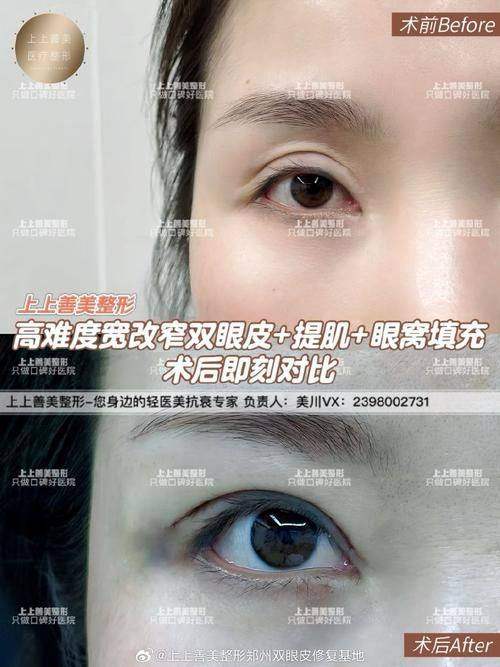 天津阳光医院整形美容科预约挂号方式