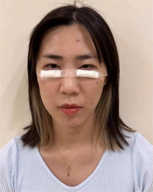 陳翰儒医生技术优势