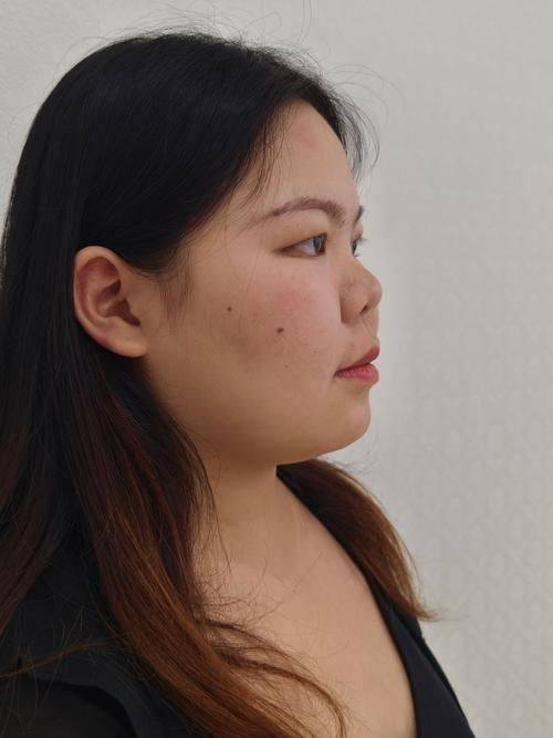 安顺赫尔美医疗美容门诊部擅长项目：