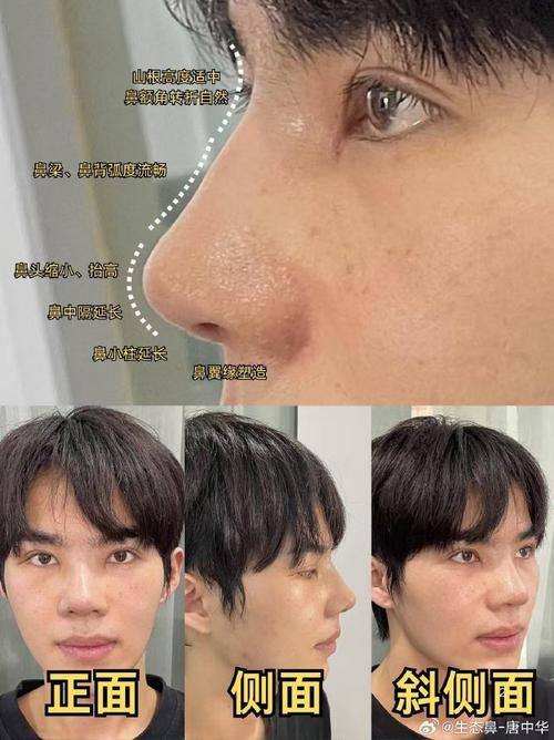 南京悦微医疗美容门诊部擅长项目：