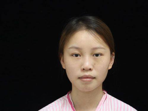 哈尔滨羽禅医疗美容门诊部(医 大医美)价格表