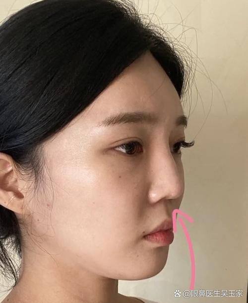 长沙凯莱美医疗美容医院擅长项目：