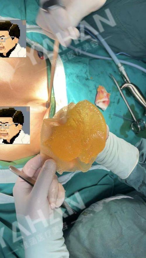 泸州医美花都医疗美容口碑评价