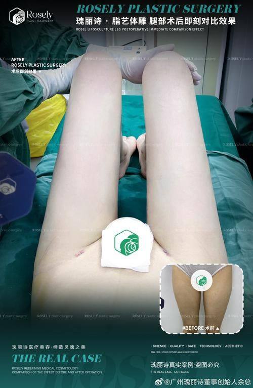 浙江台州温岭芘丽芙整形美容医院价格表：