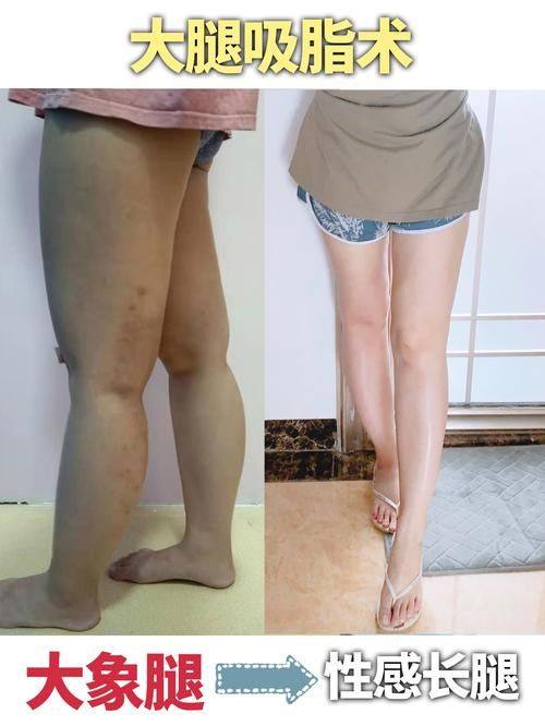 汕头中 心医院烧伤整形外科怎么样？