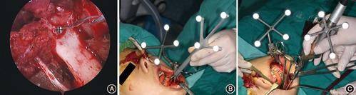 安顺赫尔美医疗美容门诊部价格表：