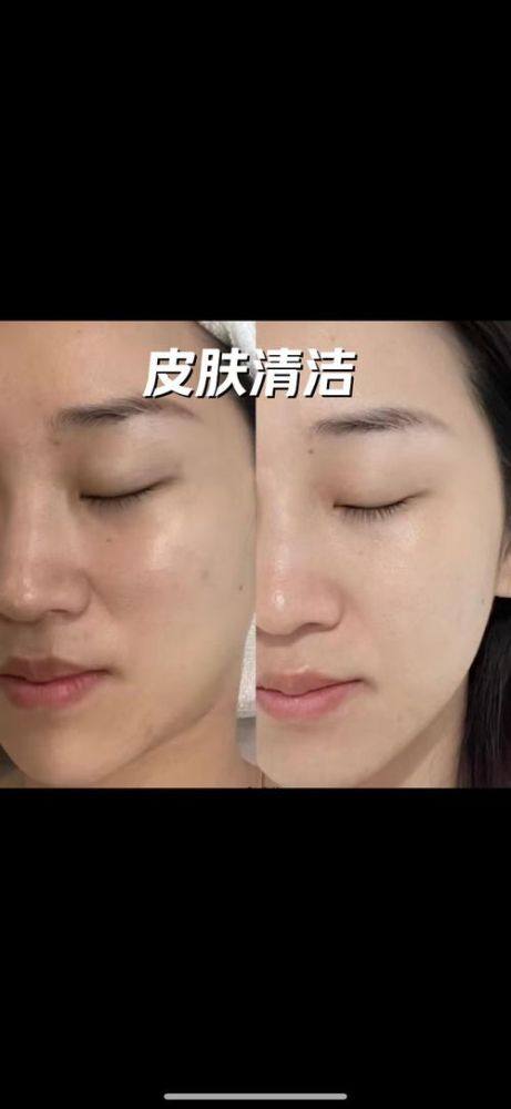 襄阳悦美整形地址电话及营业时间：