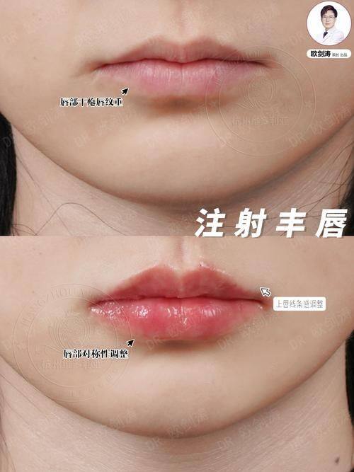 南京悦微医疗美容门诊部医生名单及擅长领域：