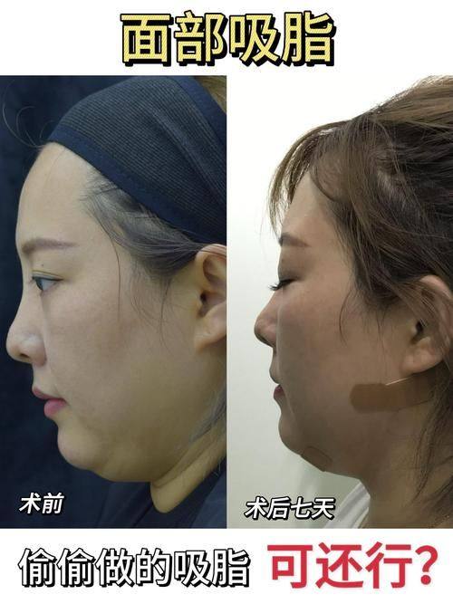 临海裕雅整形医院预约挂号方式：