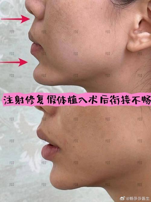 南京悦微医疗美容门诊部价格表：