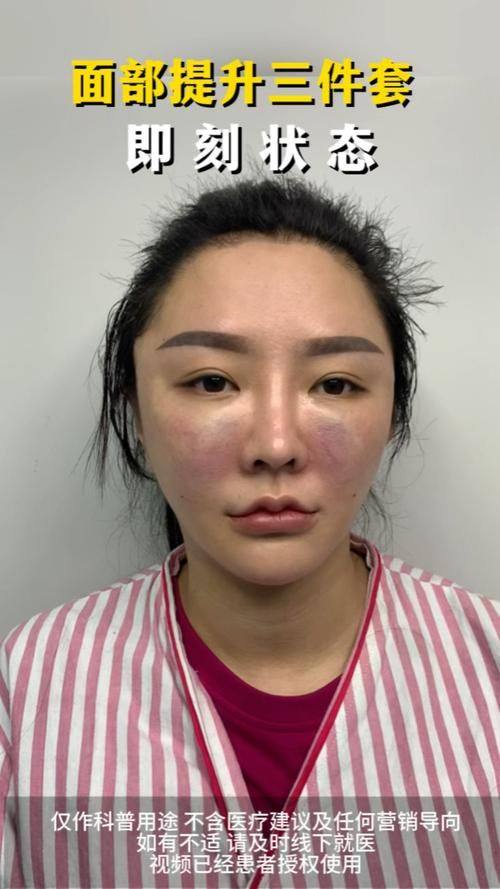 安顺赫尔美医疗美容门诊部口碑评价：