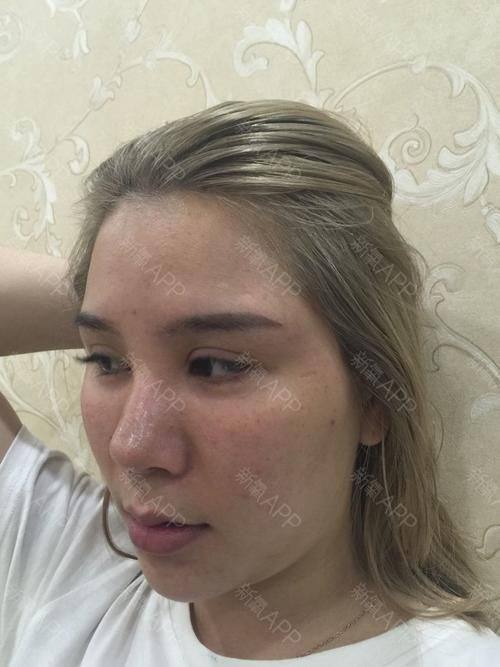 南京悦微医疗美容门诊部怎么样？