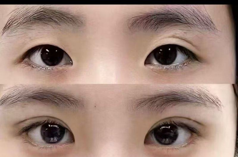 长沙凯莱美医疗美容医院价格表：