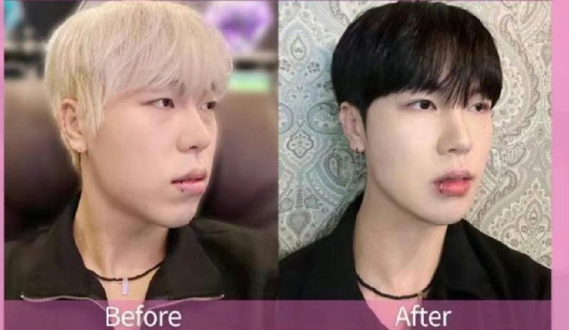 襄阳悦美整形预约挂号方式：