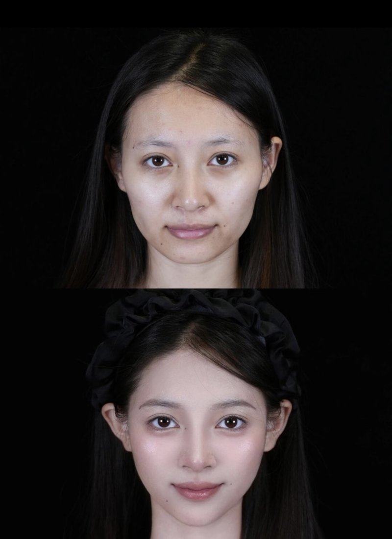 二、瓷砖疤痕怎么修复：不同情况对应不同方法