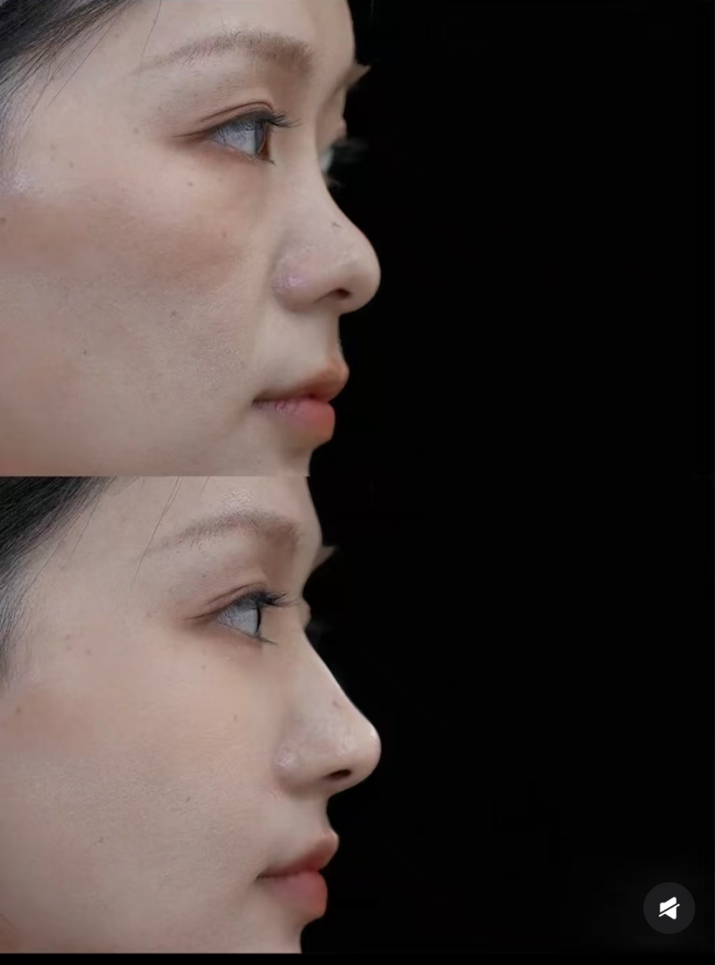 浙江台州温岭芘丽芙整形美容医院口碑评价：