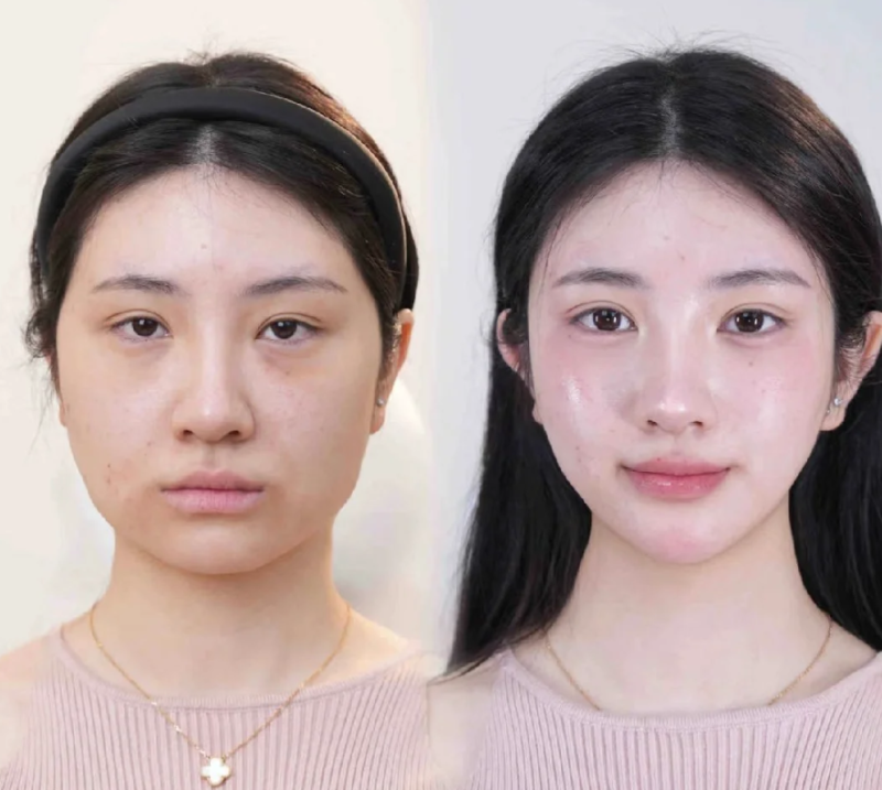 襄阳悦美整形医生名单及擅长领域：