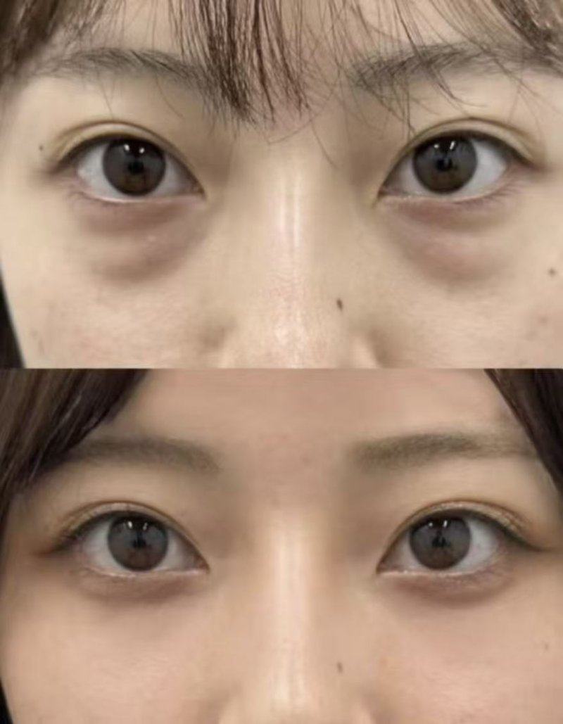 北京光合盐整形医院擅长项目：