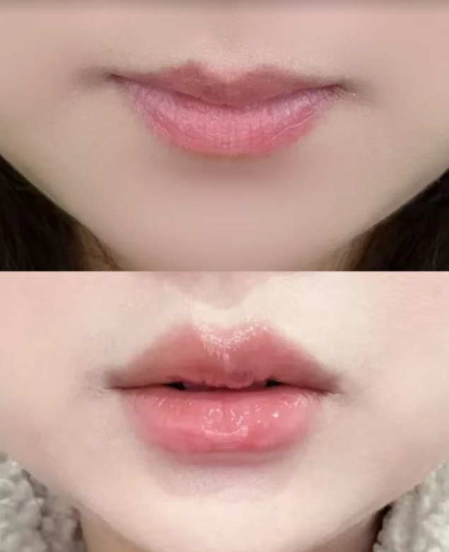 新乡市中 心医院整形美容科怎么样？