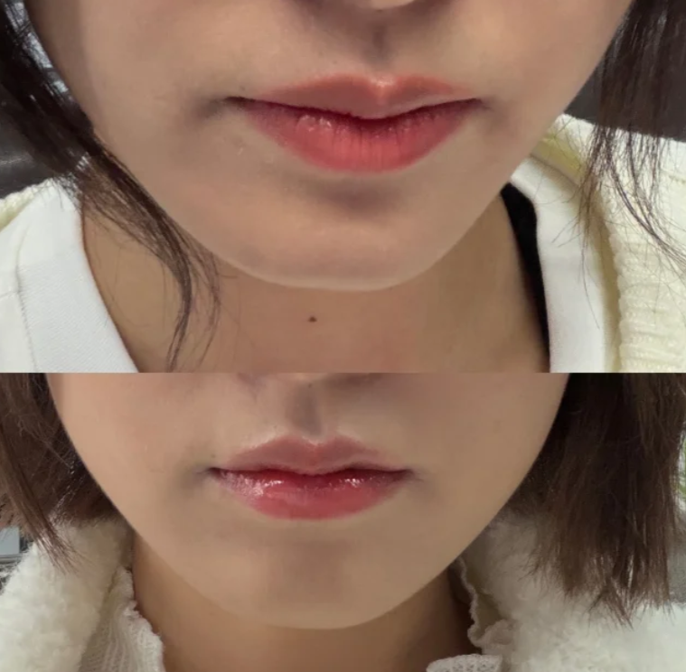 临海裕雅整形医院医生名单及擅长领域：